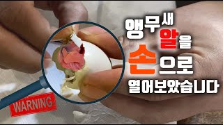 중지란이란?나도 마음아파.